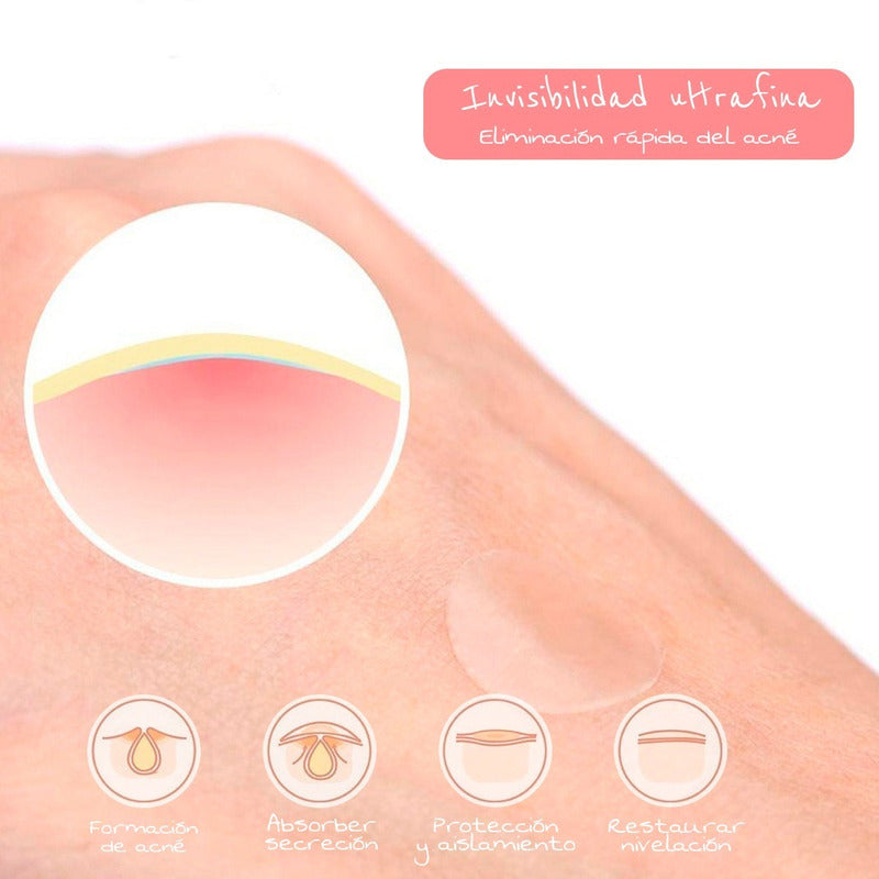 Republic Cosmetics Yuya Parche Auxiliar Para Granitos 36pz Mixta