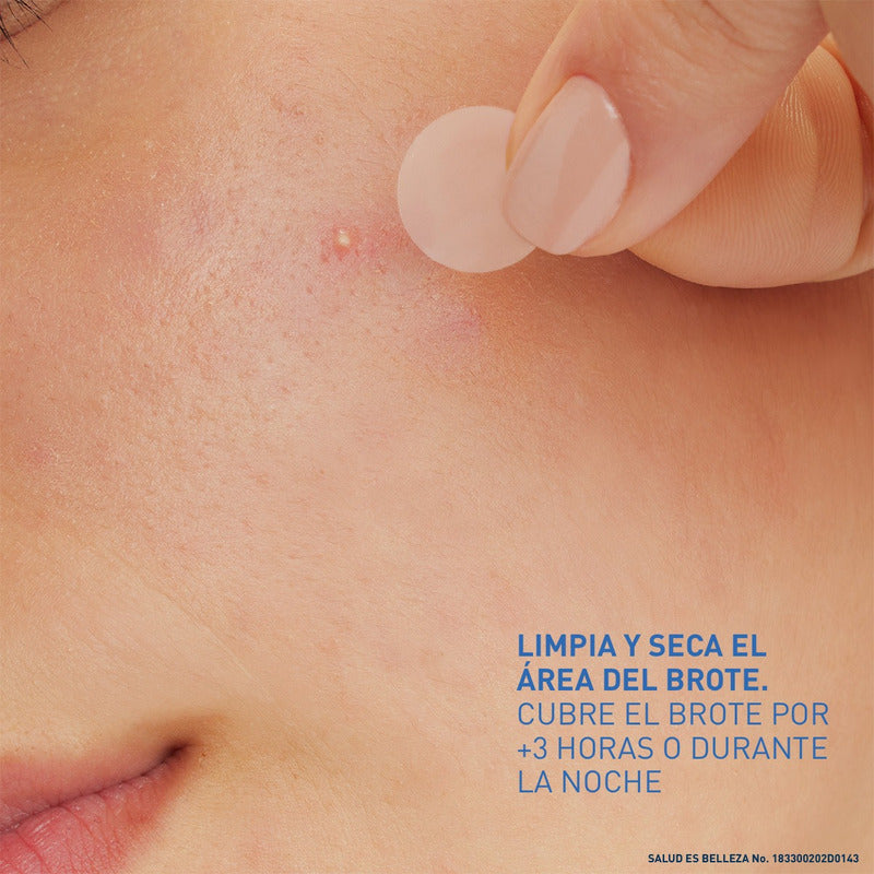 Cerave Parches Control Imperfeccion 22p Piel Tendencia Acné Todo Tipo De Piel Día/noche