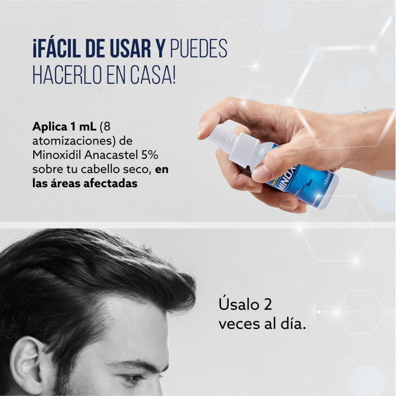 Minoxidil Anacastel 5% Solución Tratamiento Cabello Anticaida Capilar, Crecimiento Cabello Y Crecimiento De Barba Minoxidil Topico (2, 3 Y 6 Pack)