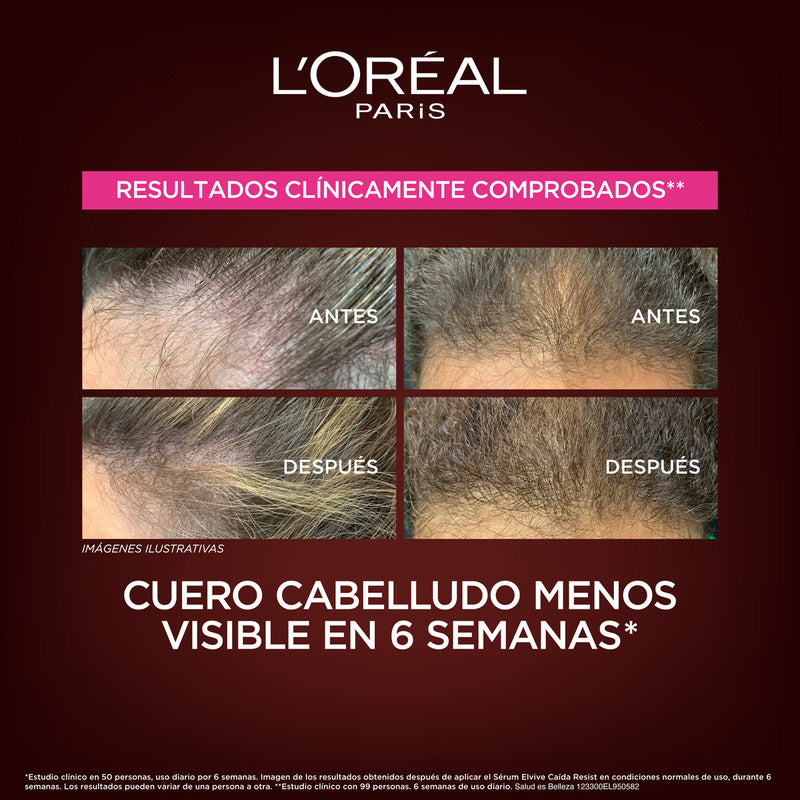 Loreal Elvive Caida Resist Aminexil Mascarilla 300g