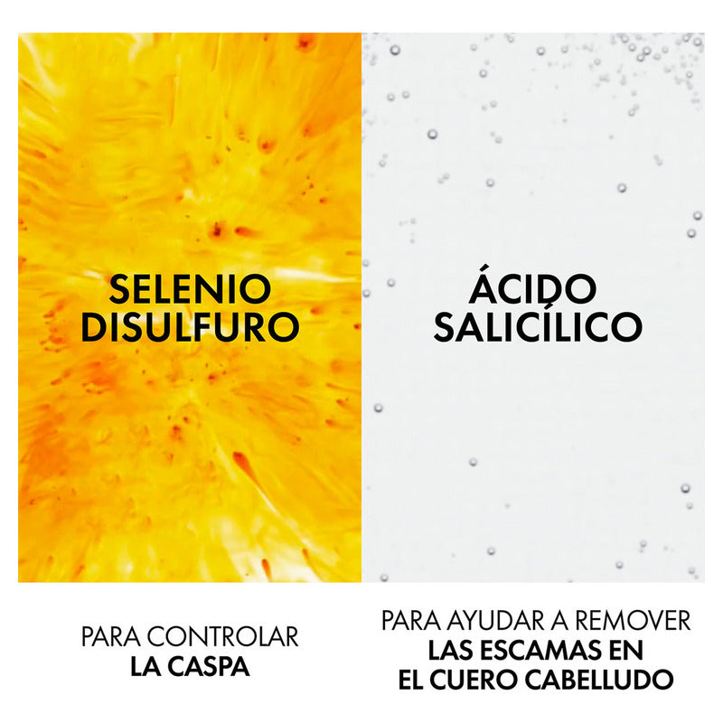 Vichy Dercos Shampoo Dermatológico Anticaspa Para Cabello Normal A Seco 390ml