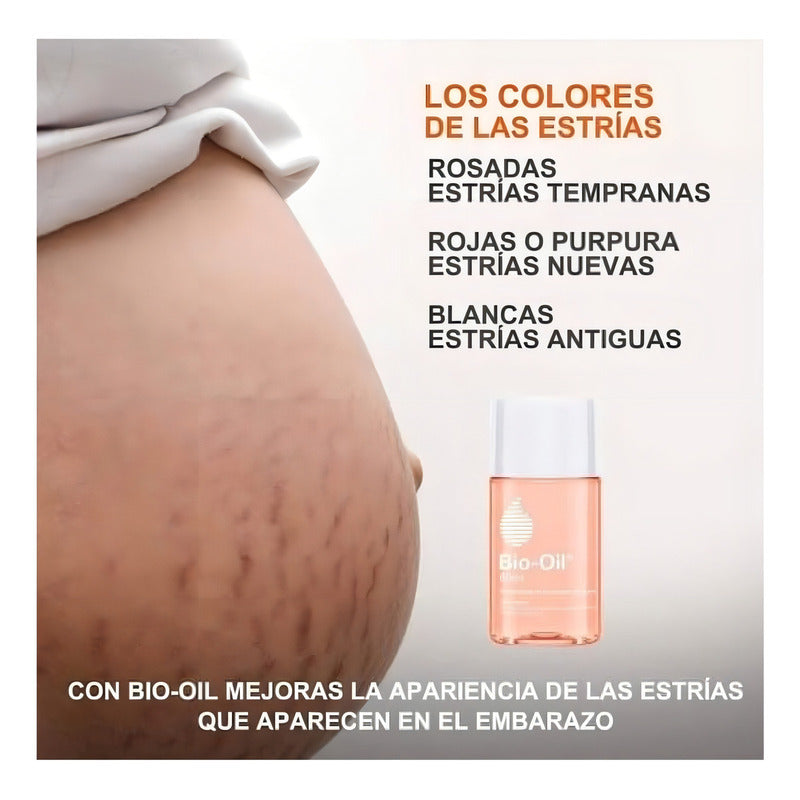 Aceite Corporal Bio Oil Para Cicatrices Y Estrías 60ml