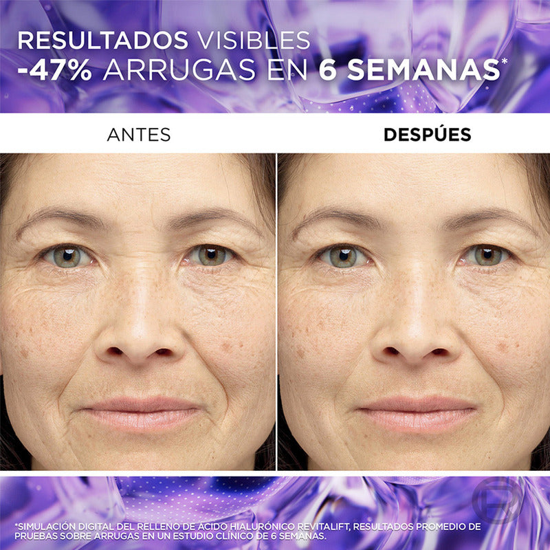L'oréal Paris Revitalift Ácido Hialurónico Sérum De Rostro, Hidrata Intensamente Y Rellena Líneas De Expresión, 30 Ml.
