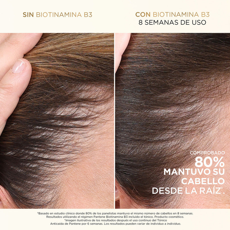 Tónico Para El Cabello Pantene Tratamiento Anticaida Con Biotionamina B3 52ml
