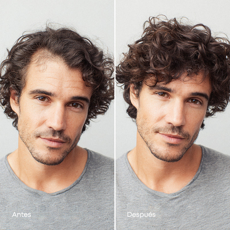 Minoxidil Anacastel 5% Solución Tratamiento Cabello Anticaida Capilar, Crecimiento Cabello Y Crecimiento De Barba Minoxidil Topico (2, 3 Y 6 Pack)