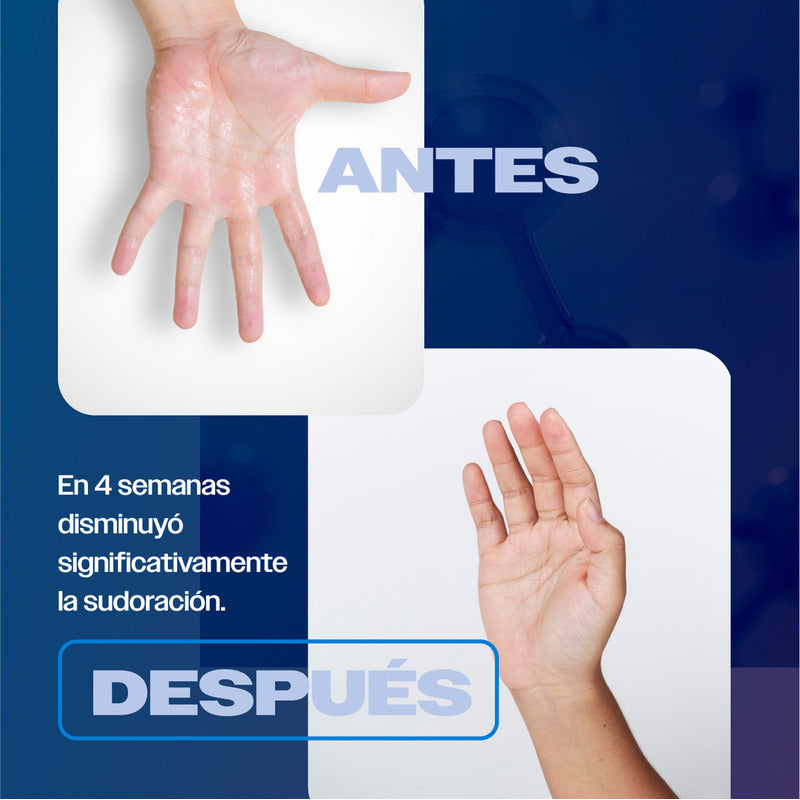 Antitranspirante Skindry Desodorante No, 20ml Protección 72 Hrs Control Sudor Mal Olor Hiperhidrosis Extra Efectivo No Mancha Ropa