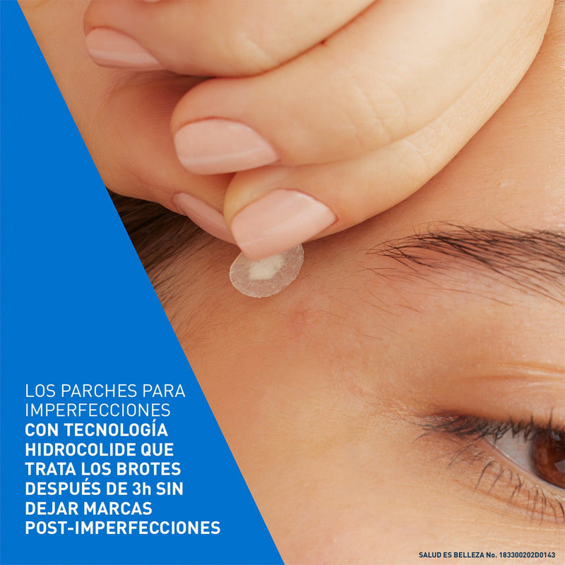 Cerave Parches Control Imperfeccion 22p Piel Tendencia Acné Todo Tipo De Piel Día/noche