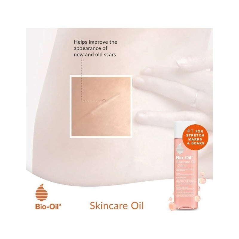 Aceite Corporal Bio Oil Para Cicatrices Y Estrías 60ml