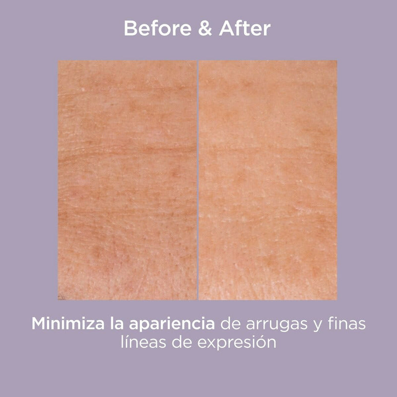 Isdinceutics Glicoisdin Gel 25% Intense 50 Ml Tipo De Piel Todo Tipo De Piel