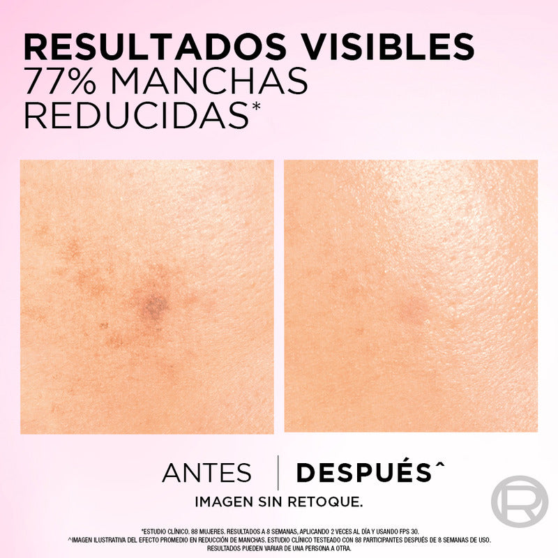 Crema Día Anti-manchas Con Ácido Glicólico L'oréal Paris Día Todo Tipo De Piel