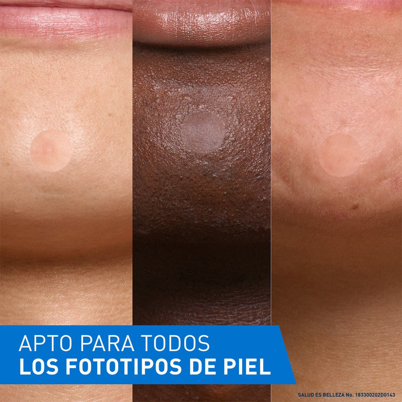 Cerave Parches Control Imperfeccion 22p Piel Tendencia Acné Todo Tipo De Piel Día/noche