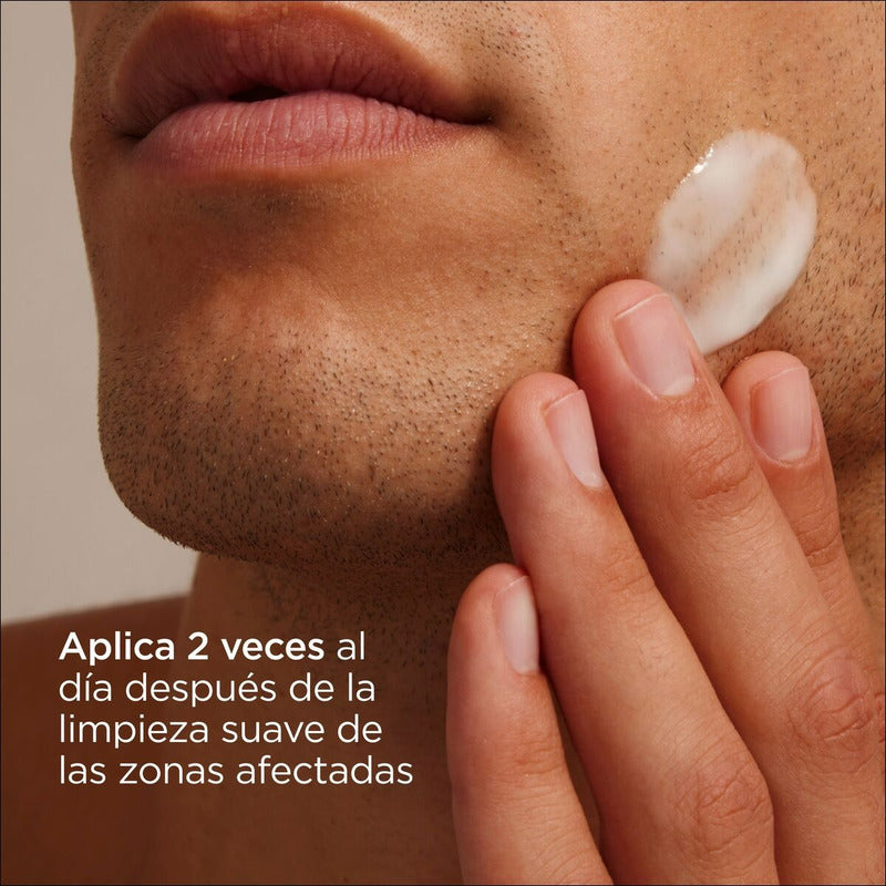 Gel Crema Facial Isdin Nutradeica Piel Seborreica 50ml