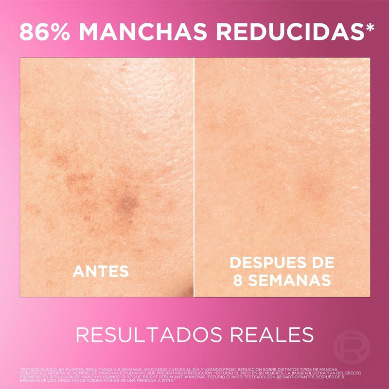 L'oréal Paris Glycolic Bright Sérum De Rostro Anti Manchas, Con Ácido Glicólico, Niacinamida Y Melasyl, Reduce Y Previene Todo Tipo De Manchas, 30 Ml.