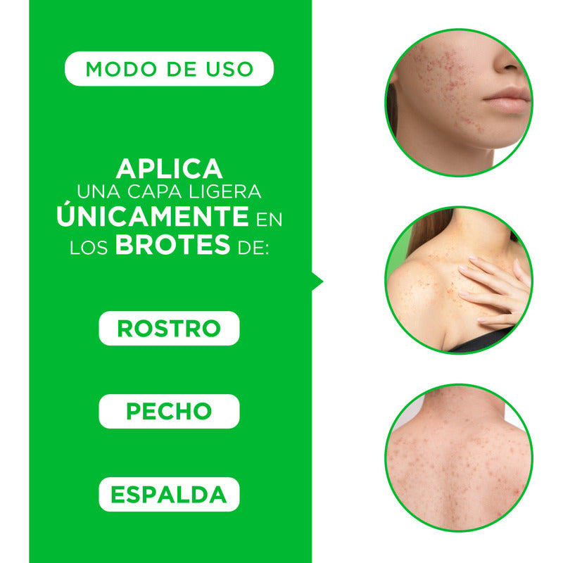 Trioximed Gel Antiimperfecciones, Controla Brotes En Piel Grasa, 30 G