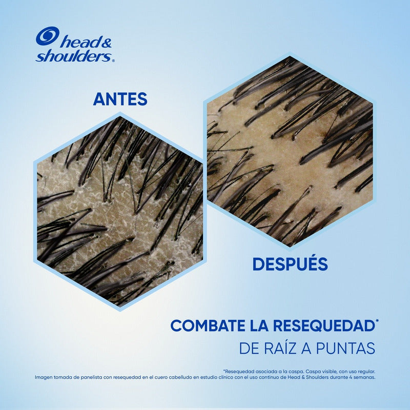 Shampoo Head & Shoulders Anti-resequedad Nutrición Diaria, Miel Aceites Y Esenciales 375 Ml